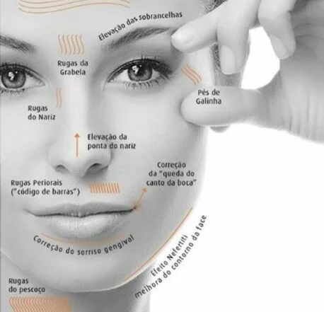 qual a função do botox